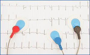 Arzt Herzkreislauferkrankung F&uuml;rth / N&uuml;rnberg, Laboruntersuchung, Untersuchung Herzkreislauferkrankungen