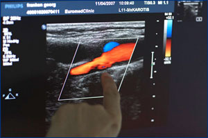 Заболевания сосудов, Врачебная практика к. м. н. Михаэля Моцны